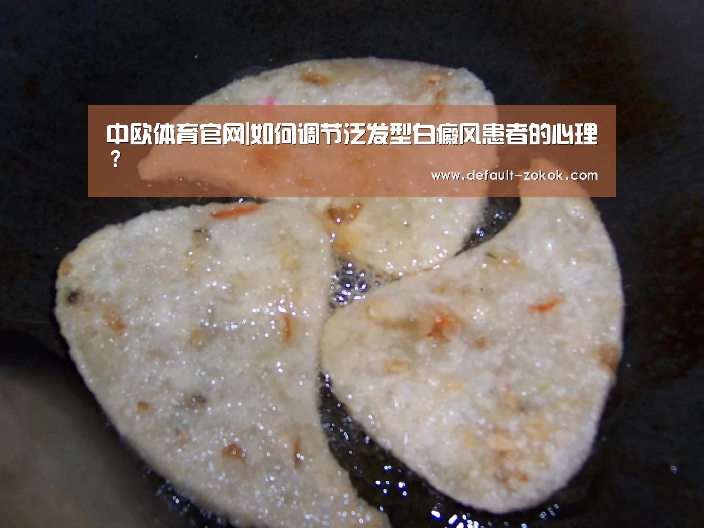 中欧体育官网|如何调节泛发型白癜风患者的心理?(图3) 中欧体育